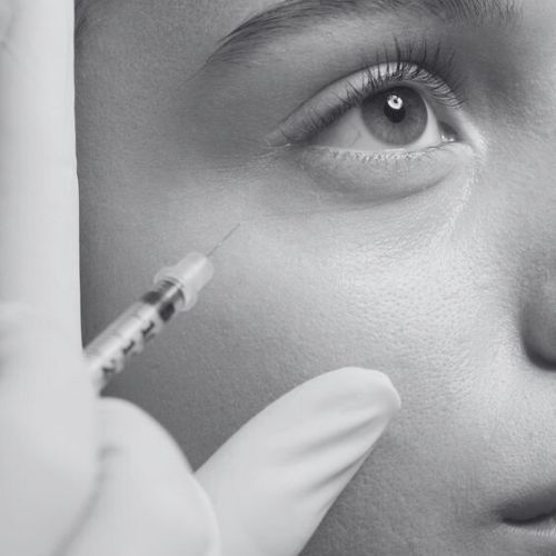 Toxina botulínica y fillers